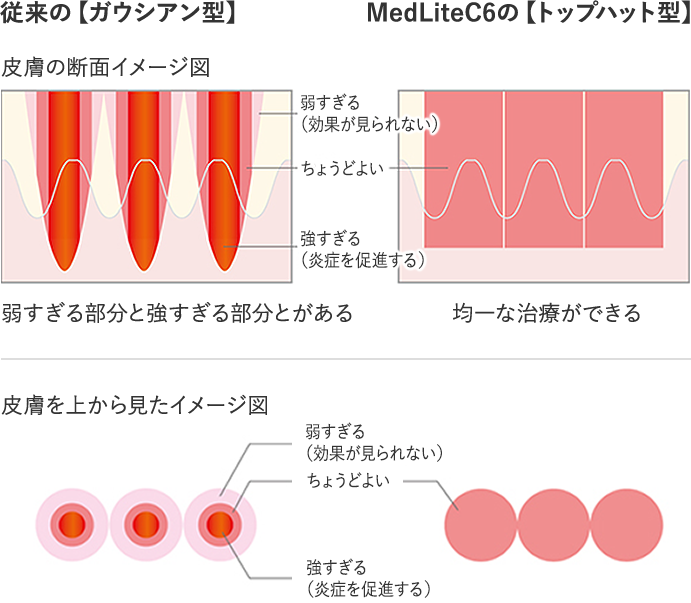 しみ 赤ら顔 くすみ 毛穴 にきび 金沢中央クリニック